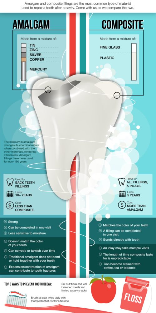 V2.Guerra.Dental.Amalgam.v.Composite.Fillings V2.Guerra.Dental.Amalgam.v.Composite.Fillings