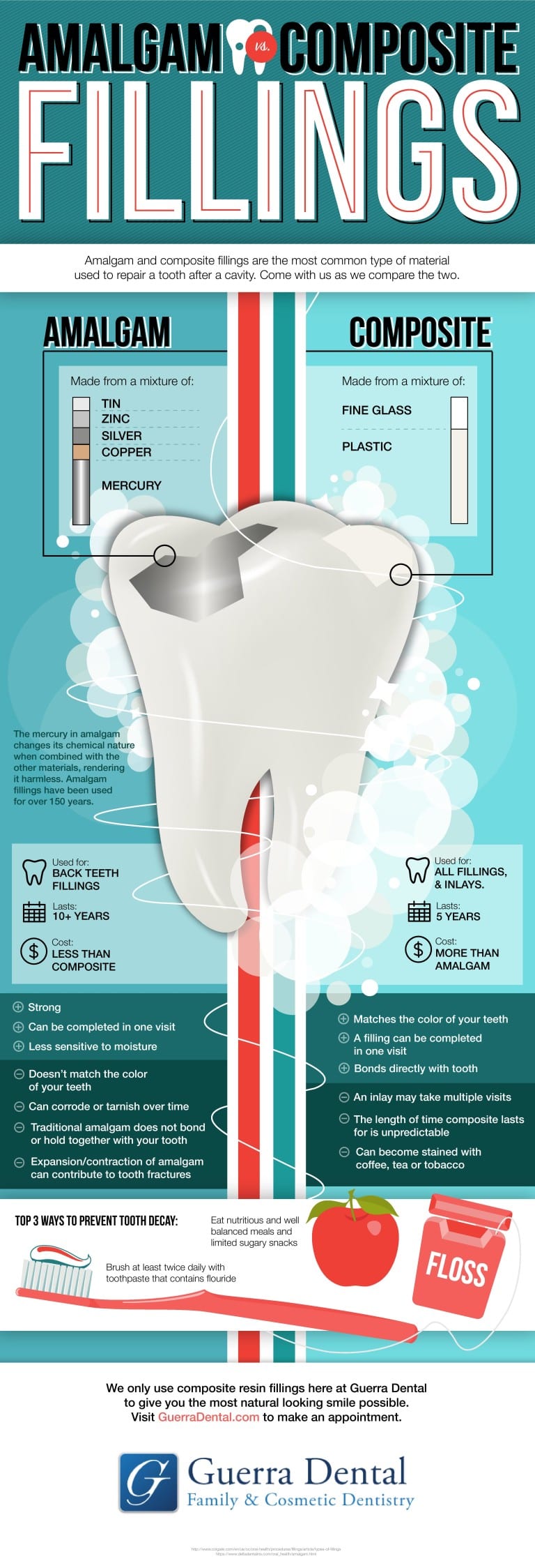 Guerra Dental Amalgam Vs Composite Fillings